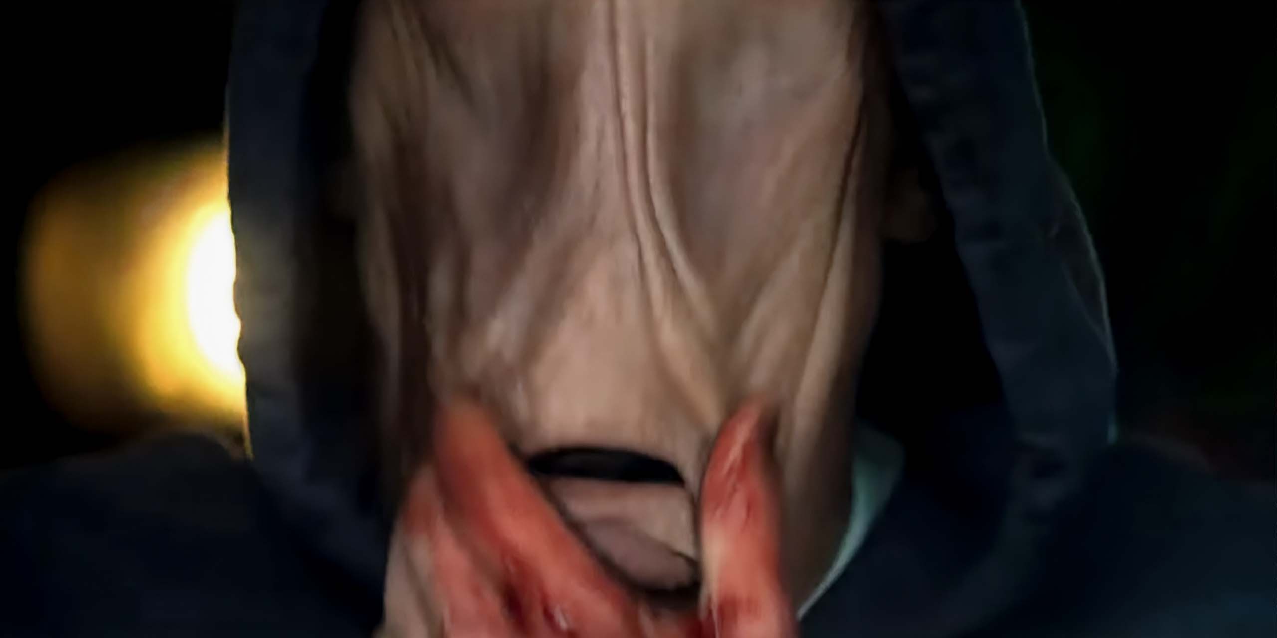 Matt Hagen (Tom Rhys Harries) le visage méconnaissable dans Clayface.